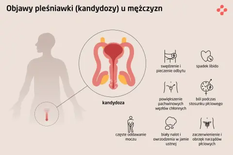 Ilustracja przedstawia objawy kandydozy u mężczyzn: pieczenie, spadek libido, powiększone węzły chłonne, ból podczas stosunku, częste oddawanie moczu, biały nalot w jamie ustnej, zaczerwienienie narządów płciowych.
