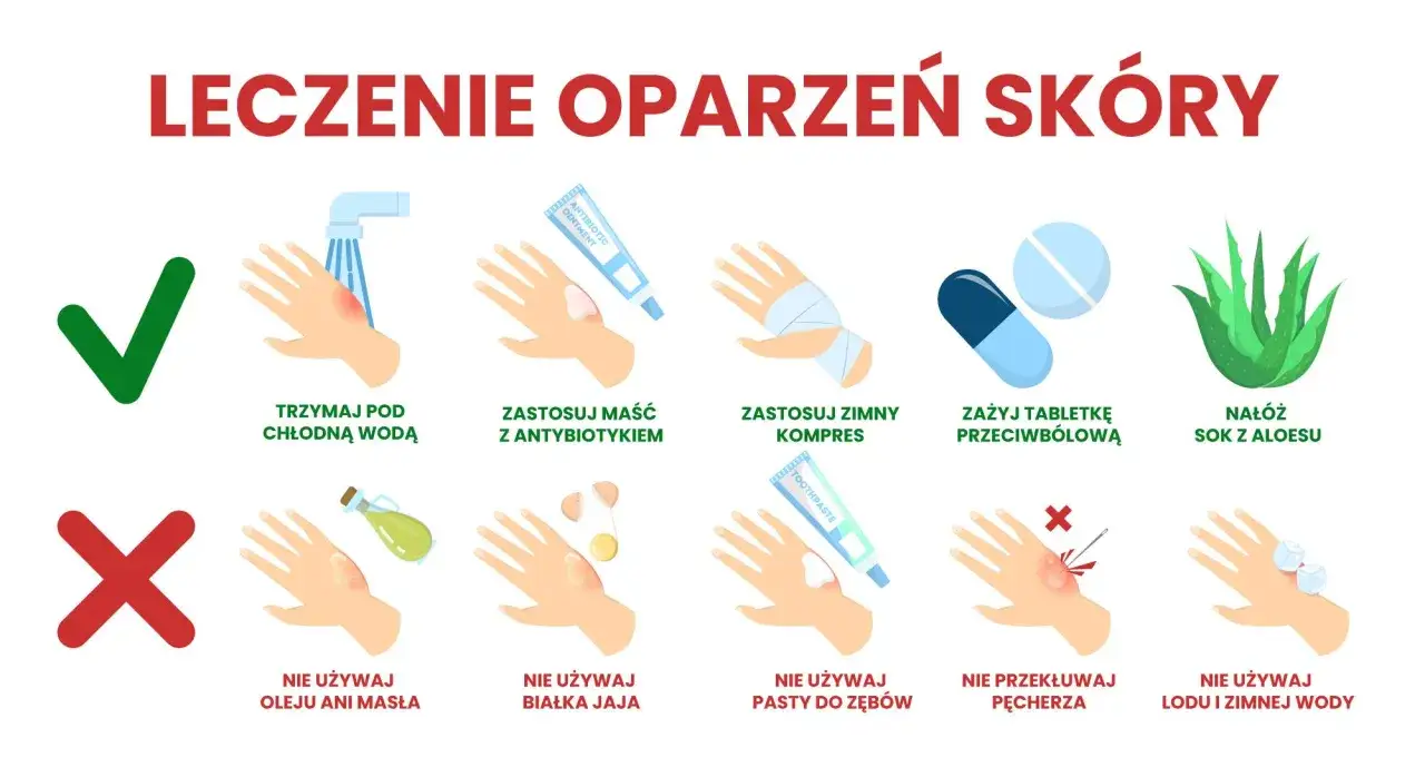 Leczenie oparzeń: chłodna woda, maść z antybiotykiem, zimny kompres, tabletki przeciwbólowe, aloes. Nie używaj masła, jajka, pasty do zębów, lodu.