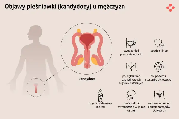 Ilustracja przedstawia objawy kandydozy u mężczyzn: pieczenie, spadek libido, powiększone węzły chłonne, ból podczas stosunku, częste oddawanie moczu, biały nalot w jamie ustnej, zaczerwienienie narządów płciowych.